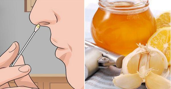 Phương Pháp Giúp Chữa Viêm Xoang Nặng 10 Năm Cũng Khỏi, Không Lo Tái Phát